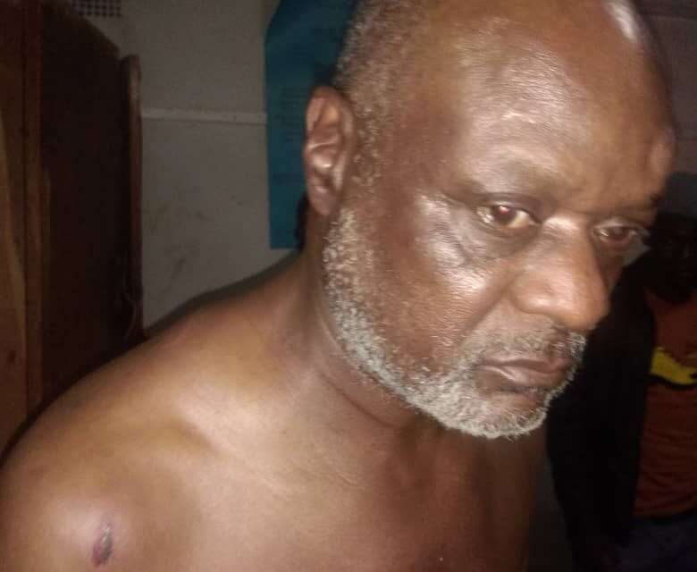 Zanu PF Thugs Beat and Injure CCC Businessman at Bikita West Business Centre