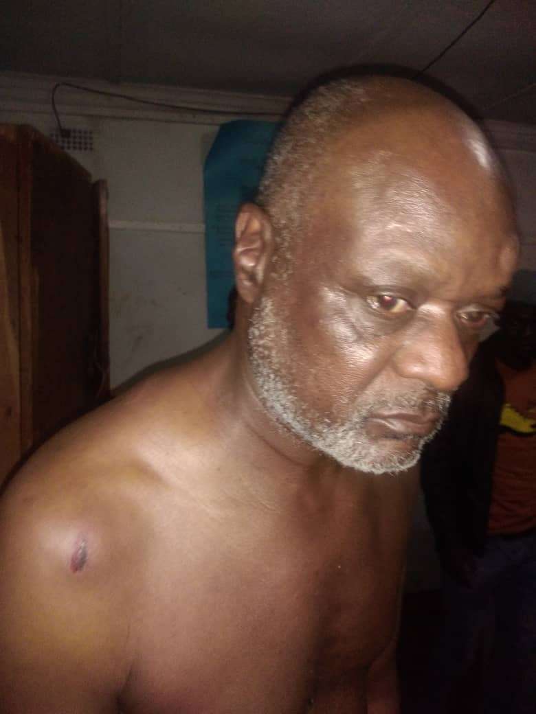 See picture of injured Mr. Makuwe